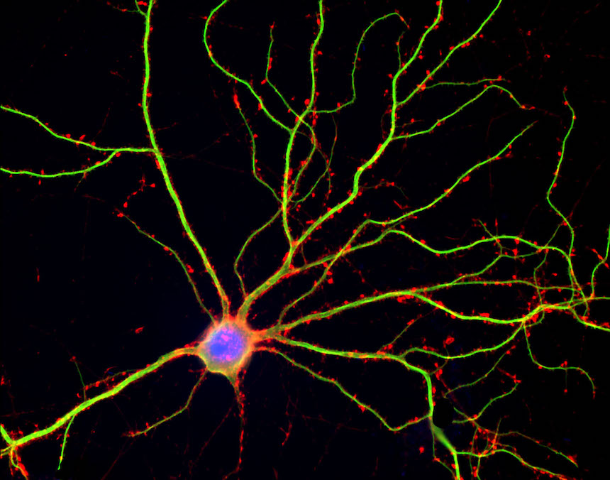 Have you ever wondered why we are Spines?
